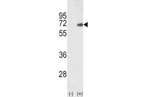 Western Blotting (WB) image for anti-SMAD Family Member 4 (SMAD4) (AA 400-428) antibody (ABIN3032608)