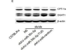 rAAV-miR-30c-5p attenuated hepatic steatosis in db/db mice(A and B) Histological analysis of hepatocyte by H&E and Oil Red O staining. (CPT1A antibody  (AA 497-756))