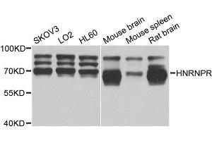 Western blot analysis of extracts of various cell lines, using HNRNPR antibody (ABIN5975822) at 1/1000 dilution. (HNRNPR antibody)