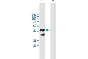 Western Blot analysis of EPCAM expression in transfected 293T cell line by EPCAM MaxPab polyclonal antibody. (EpCAM antibody  (AA 1-314))