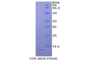 SDS-PAGE (SDS) image for Diazepam Binding Inhibitor (DBI) (AA 2-87) protein (His tag) (ABIN2120962) (Diazepam Binding Inhibitor Protein (DBI) (AA 2-87) (His tag))