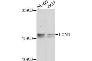Western blot analysis of extracts of various cell lines, using LCN1 antibody (ABIN6003560) at 1/1000 dilution. (Lipocalin 1 antibody)