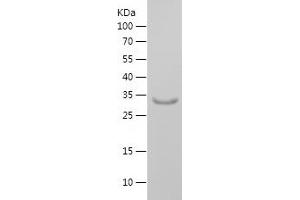 Western Blotting (WB) image for Potassium Voltage-Gated Channel, Shaker-Related Subfamily, beta Member 2 (KCNAB2) (AA 122-210) protein (His-IF2DI Tag) (ABIN7282449) (KCNAB2 Protein (AA 122-210) (His-IF2DI Tag))