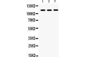 Western Blotting (WB) image for anti-Integrin Alpha2b (CD41) (AA 677-711), (C-Term) antibody (ABIN3043254) (Integrin Alpha2b antibody  (C-Term))
