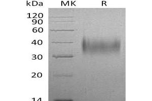 Western Blotting (WB) image for CD16 (CD16) protein (His tag) (ABIN7320834) (CD16 Protein (CD16) (His tag))