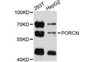 Western blot analysis of extracts of various cell lines, using PORCN antibody (ABIN5998572) at 1:3000 dilution. (PORCN antibody)