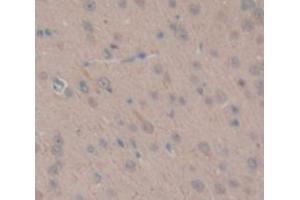 Figure. (TGM1 antibody  (AA 504-737))