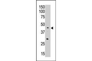 The APOBEC3G polyclonal antibody  is used in Western blot to detect APOBEC3G in A-549 cell lysate. (APOBEC3G antibody  (Internal Region))