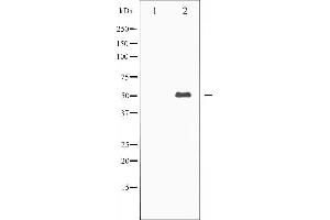 Western blot analysis of Keratin 8 expression in EGF treated 293 whole cell lysates,The lane on the left is treated with the antigen-specific peptide. (KRT8 antibody  (C-Term))