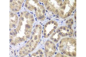 Immunohistochemistry of paraffin-embedded Human kidney using MAP2K4 Polyclonal Antibody at dilution of 1:100 (40x lens).