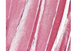 Immunohistochemical analysis of paraffin-embedded human skeletal musle tissues using DDR2 mouse mAb. (DDR2 antibody)