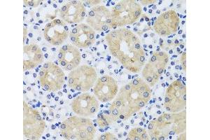 Immunohistochemistry of paraffin-embedded Mouse kidney using FGF13 Polyclonal Antibody at dilution of 1:100 (40x lens). (FGF13 antibody)