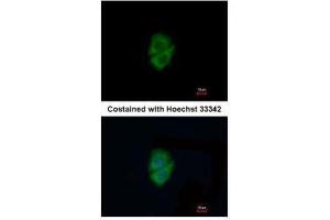 ICC/IF Image Immunofluorescence analysis of methanol-fixed A549, using Decorin, antibody at 1:200 dilution. (Decorin antibody)