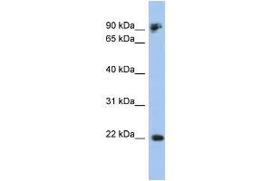 WB Suggested Anti-CDH1 Antibody Titration:  0. (E-cadherin antibody  (Middle Region))
