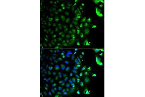 Immunofluorescence analysis of HeLa cell using RAB5A antibody. (RAB5 antibody  (AA 1-215))