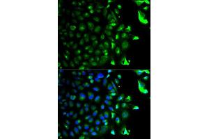 Immunofluorescence analysis of HeLa cell using RAB5A antibody. (RAB5 antibody  (AA 1-215))