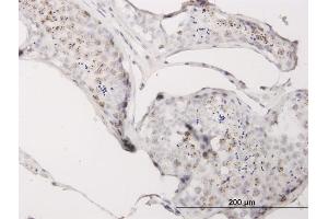 Immunoperoxidase of monoclonal antibody to CGGBP1 on formalin-fixed paraffin-embedded human testis. (CGGBP1 antibody  (AA 58-167))