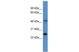 WB Suggested Anti-Tfdp1 Antibody Titration:  0. (DP1 antibody  (N-Term))