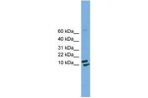 WB Suggested Anti-PPIH  Antibody Titration: 0. (PPIH antibody  (Middle Region))