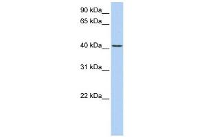 TMEM144 antibody used at 1 ug/ml to detect target protein. (TMEM144 antibody  (Middle Region))