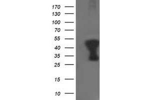 HEK293T cells were transfected with the pCMV6-ENTRY control (Left lane) or pCMV6-ENTRY TMOD1 (Right lane) cDNA for 48 hrs and lysed. (Tropomodulin 1 antibody)