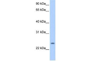 PQLC1 antibody used at 0.
