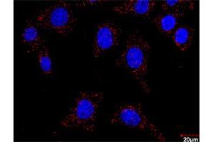 Proximity Ligation Analysis of protein-protein interactions between FLT1 and CRKL. (FLT1 antibody  (AA 1-687))