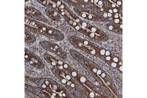 Immunohistochemical staining of human duodenum with UCN3 polyclonal antibody  shows strong granular cytoplasmic positivity in glandular cells at 1:200-1:500 dilution.