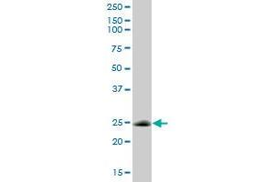 CSEN MaxPab polyclonal antibody. (DREAM antibody  (AA 1-256))
