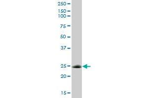 CSEN MaxPab polyclonal antibody.