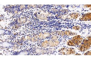 Detection of CXCR4 in Human Stomach Tissue using Polyclonal Antibody to Chemokine C-X-C-Motif Receptor 4 (CXCR4) (CXCR4 antibody  (AA 262-352))