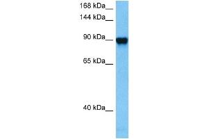 Host:  Mouse  Target Name:  GRM6  Sample Tissue:  Mouse Kidney  Antibody Dilution:  1ug/ml (Metabotropic Glutamate Receptor 6 antibody  (C-Term))