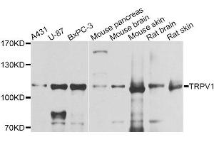 Western blot analysis of extracts of various cell lines, using TRPV1 antibody (ABIN5996282) at 1/1000 dilution. (TRPV1 antibody)