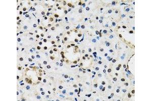 Immunohistochemistry of paraffin-embedded Mouse kidney using JADE1 Polyclonal Antibody at dilution of 1:100 (40x lens). (PHF17 antibody)