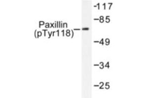 Image no. 1 for anti-Paxillin (PXN) (pTyr118) antibody (ABIN318100) (Paxillin antibody  (pTyr118))
