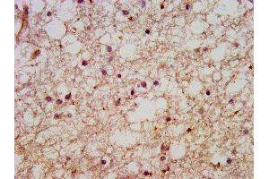 IHC image of ABIN7151025 diluted at 1:600 and staining in paraffin-embedded human brain tissue performed on a Leica BondTM system.