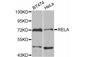 Western blot analysis of extracts of various cell lines, using RELA antibody. (NF-kB p65 antibody)
