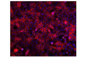 IF analysis of EGFR using anti-EGFR antibody (ABIN7601478). (EGFR antibody  (AA 36-497))