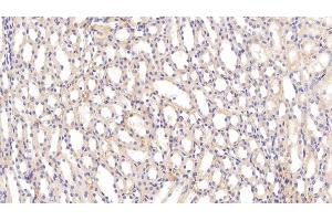 Detection of APOE in Rat Kidney Tissue using Polyclonal Antibody to Apolipoprotein E (APOE)