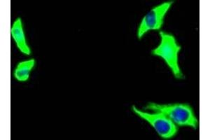 Immunofluorescence staining of HepG2 Cells with ABIN7127528 at 1:50, counter-stained with DAPI. (Recombinant Growth Hormone Receptor antibody)