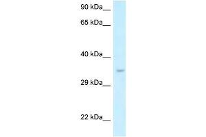 WB Suggested Anti-Six1 Antibody   Titration: 1. (SIX Homeobox 1 antibody  (N-Term))