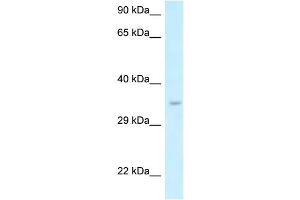 WB Suggested Anti-Six1 Antibody   Titration: 1.