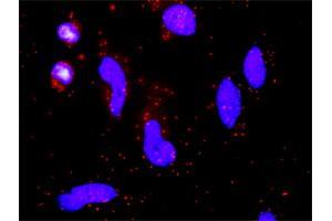 Proximity Ligation Analysis of protein-protein interactions between F7 and F3. (Factor VII antibody  (AA 1-444))