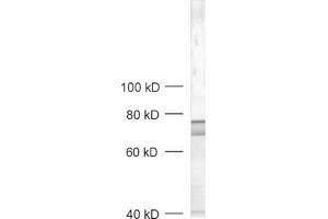 dilution: 1 : 1000, sample: crude synaptic vesicle fraction of rat brain (LP2) (RPH3A antibody  (AA 671-684))