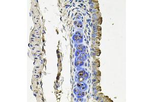 Immunohistochemistry of paraffin-embedded mouse lung using FLT1 antibody (ABIN4903685) at dilution of 1:100 (40x lens).