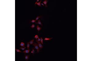 ABIN6266509 staining MCF-7 cells by IF/ICC.