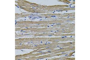 Immunohistochemistry of paraffin-embedded rat heart using EIF1AY antibody (ABIN1875833) at dilution of 1:100 (40x lens).