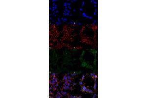 Immunocytochemistry/Immunofluorescence analysis using Mouse Anti-Hexanoyl-Lysine adduct Monoclonal Antibody, Clone 5D9 . (Hexanoyl-Lysine Adduct (HEL) antibody (Atto 488))