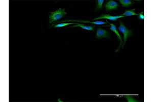 Immunofluorescence of purified MaxPab antibody to CAPN2 on HeLa cell. (Calpain 2 antibody  (AA 1-700))
