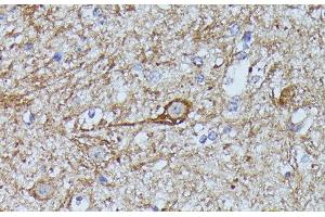 Immunohistochemistry of paraffin-embedded Mouse spinal cord using FKBP1B Polyclonal Antibody at dilution of 1:100 (40x lens). (FKBP1B antibody)